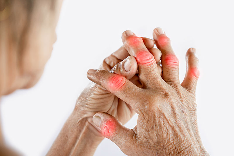 Ursachen von Polyarthritis Gelenkschmerzen Ursachen von Polyarthritis Gelenkschmerzen